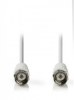 F Female to F Female 1.5m Cable (OEM)